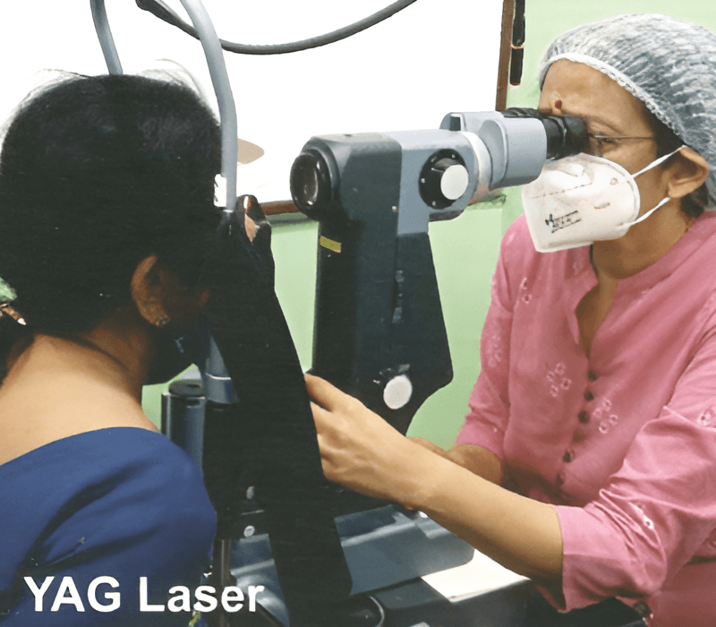YAG Laser