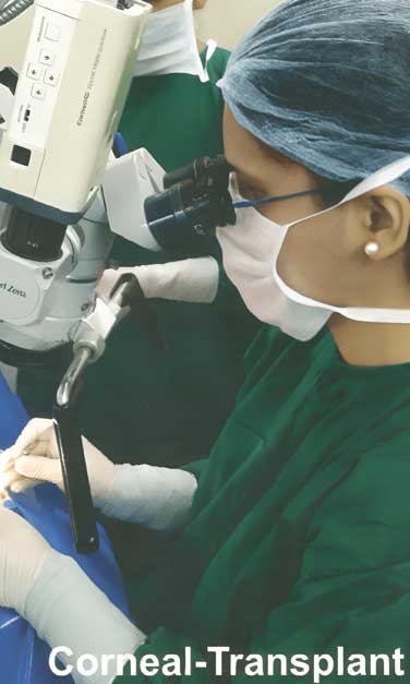 Corneal Transplant