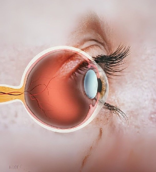 Advanced Corneal Services