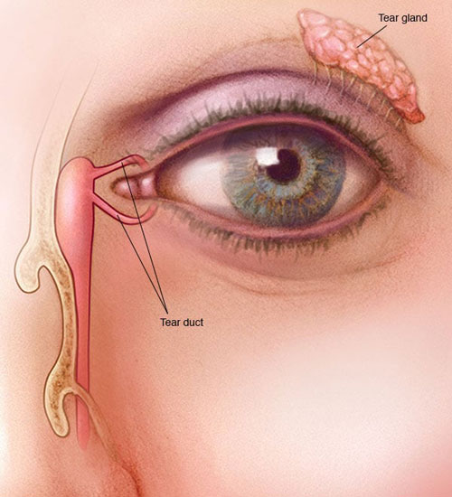 DCR (Dacryocystorhinostomy)